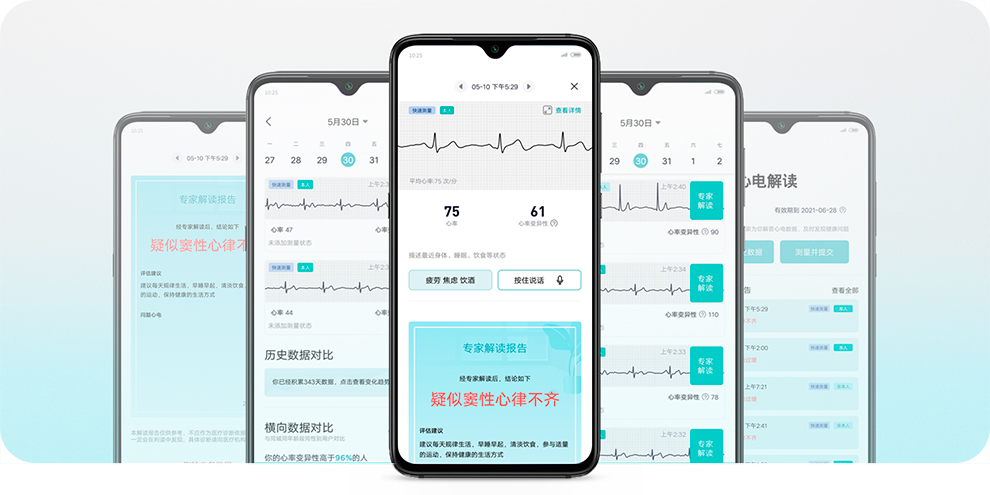 Смарт-часы Xiaomi Huami Amazfit Health Watch